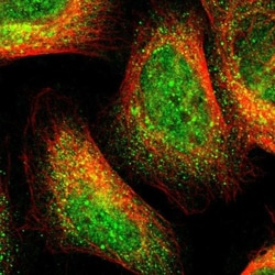 C1GALT1 Antibody, Novus Biologicals 0.1mL; Unlabeled:Antibodies, Polyclonal